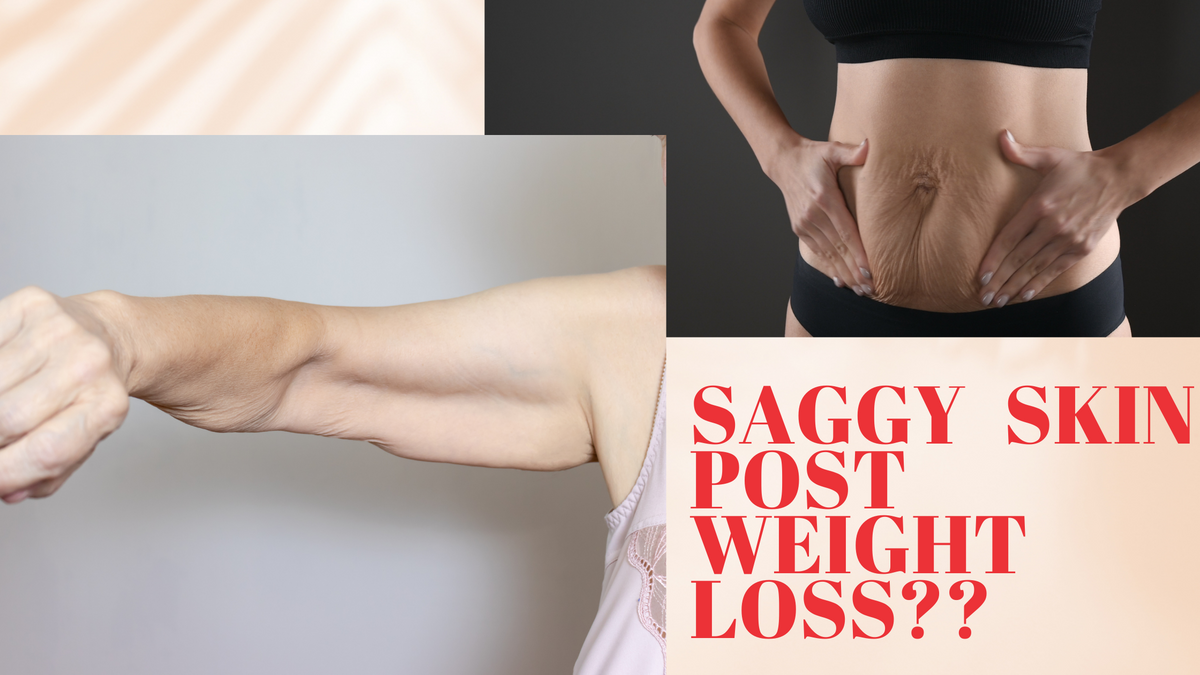 Saggy Skin Post Weight Loss? — Roshni Sanghvi