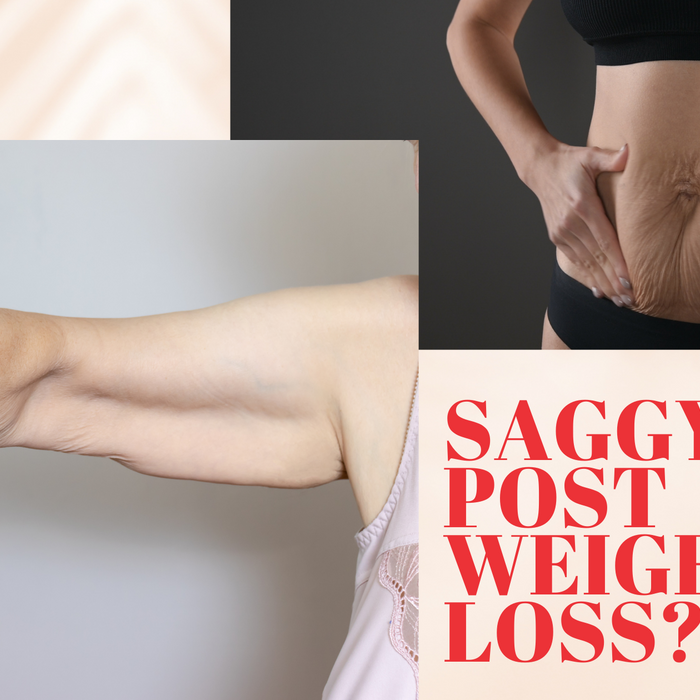 Saggy Skin Post Weight Loss?