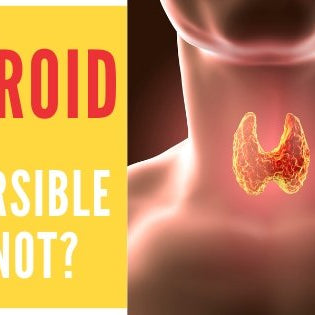 Thyroid- Reversible or not? - Roshni Sanghvi